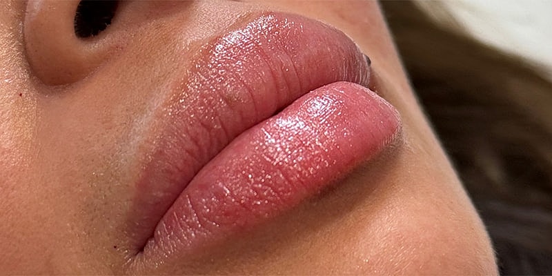 Close-up of glossy, full lips.