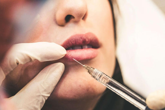 Everything You Need To Know About Lip Filler Before Making An Appointment